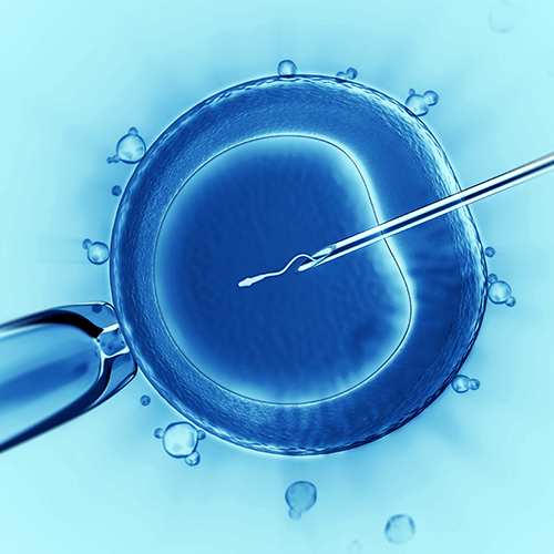 Advantage And Disadvantage Of Icsi Global Ivf Fertility 